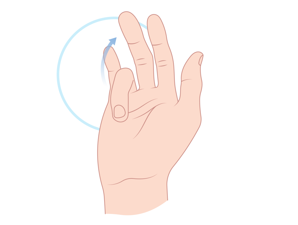 Dupuytren's Contracture