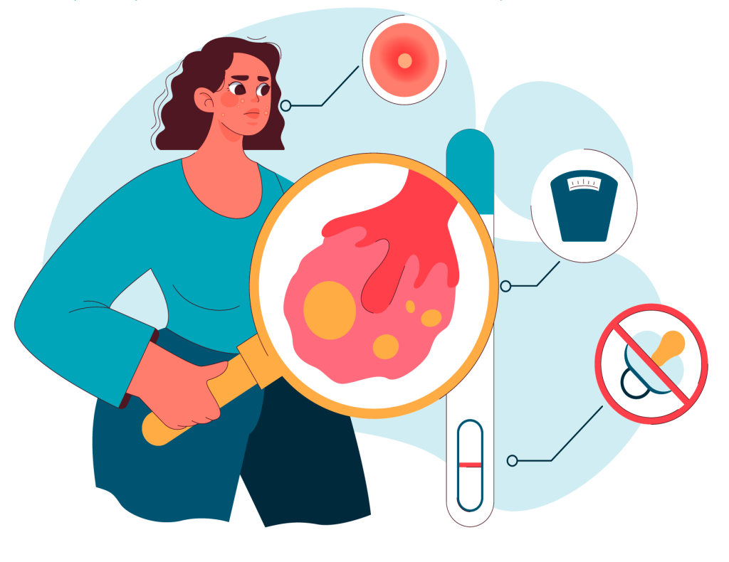 Polycystic Ovarian Syndrome
