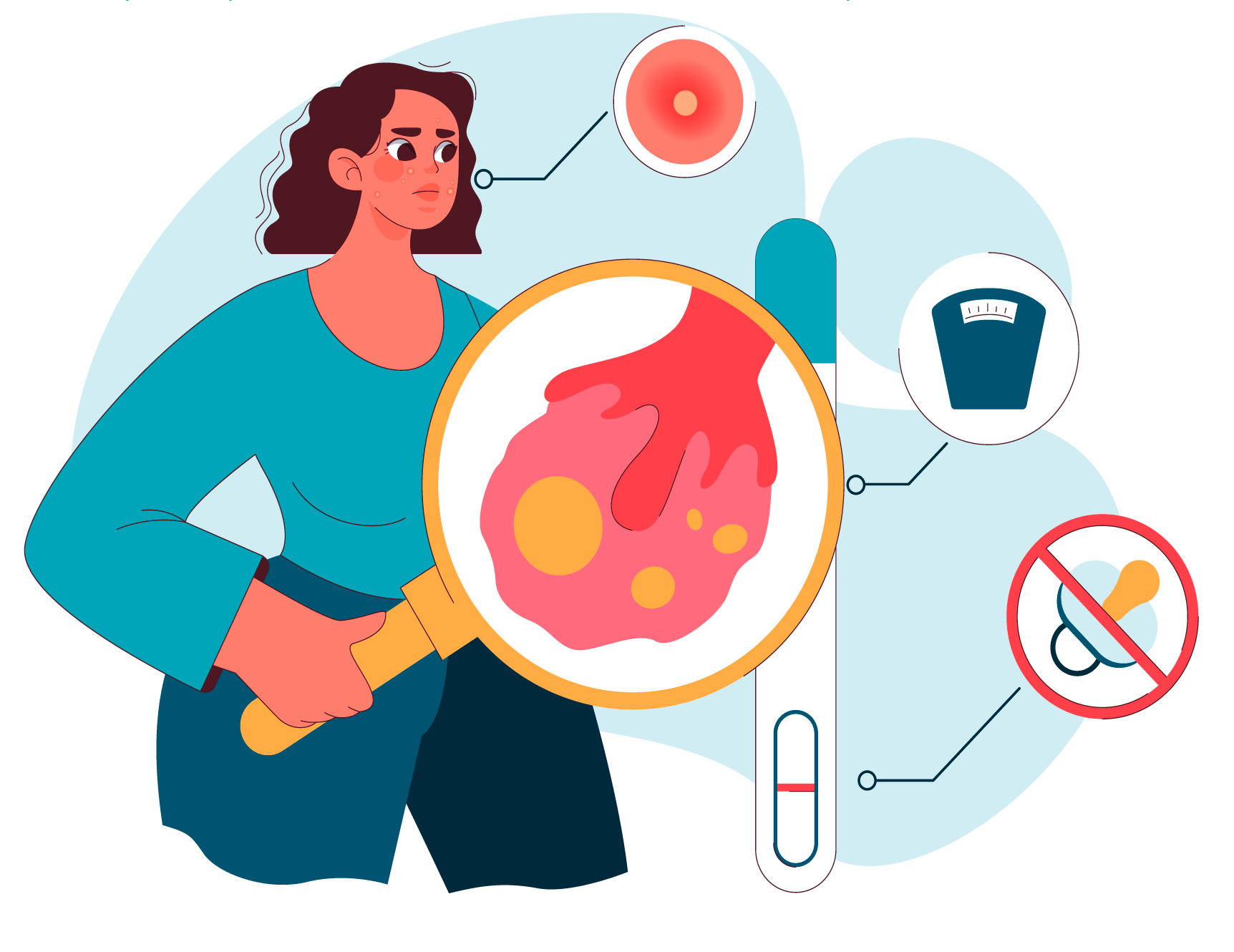 Polycystic ovarian syndrome (PCOS) – Hormonal imbalance may contribute to liver fat.